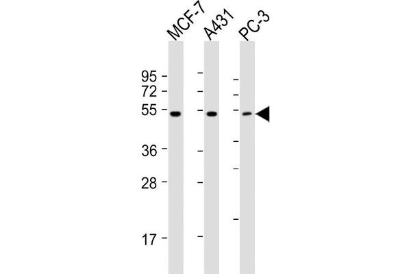 PPP2R5E antibody  (C-Term)