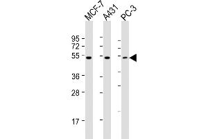 All lanes : Anti-P2R5E Antibody (C-term) at 1:2000 dilution Lane 1: MCF-7 whole cell lysates Lane 2: A431 whole cell lysates Lane 3: PC-3 whole cell lysates Lysates/proteins at 20 μg per lane. (PPP2R5E antibody  (C-Term))