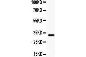 Anti- GST3/GST pi Picoband antibody, Western blotting All lanes: Anti GST3/GST pi at 0. (GSTP1 antibody  (AA 2-210))