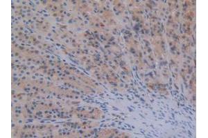 IHC-P analysis of Rat Stomach Tissue, with DAB staining. (STAT2 antibody  (AA 587-838))