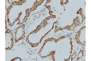 IHC analysis of LSM8 using anti-LSM8 antibody (ABIN7599578).