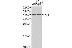 Western Blotting (WB) image for anti-Tissue Factor Pathway Inhibitor (Lipoprotein-Associated Coagulation Inhibitor) (TFPI) antibody (ABIN1875071) (TFPI antibody)