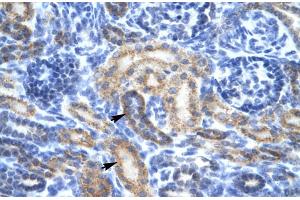 Rabbit Anti-OR13C9 Antibody Catalog Number: ARP31898 Paraffin Embedded Tissue: Human Kidney Cellular Data: Epithelial cells of renal tubule Antibody Concentration: 4. (OR13C9 antibody  (Middle Region))