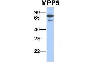 Host:  Rabbit  Target Name:  MPP5  Sample Type:  Human Fetal Lung  Antibody Dilution:  1. (MPP5 antibody  (N-Term))