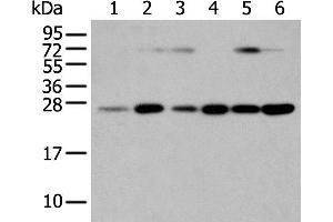 Western Blotting (WB) image for anti-Synaptosomal-Associated Protein, 23kDa (SNAP23) antibody (ABIN2424184) (SNAP23 antibody)