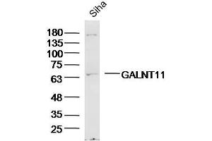 Siha Cell lysates probed with GALNT11/GalNAc-T11 Polyclonal Antibody, unconjugated  at 1:300 overnight at 4°C followed by a conjugated secondary antibody for 60 minutes at 37°C. (GALNT11 antibody  (AA 401-500))