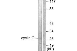 Western Blotting (WB) image for anti-Cyclin G1 (CCNG1) (Internal Region) antibody (ABIN1848500) (Cyclin G1 antibody  (Internal Region))