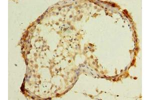 Immunohistochemistry of paraffin-embedded human testis tissue using ABIN7174599 at dilution of 1:100 (UBXN6 antibody  (AA 1-388))