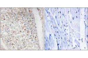 Immunohistochemistry analysis of paraffin-embedded human heart, using PKD1/2/3/PKC mu (Phospho-Ser738+Ser742) Antibody. (PKD1/2/3/PKC mu (AA 706-755), (pSer738) antibody)