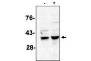 Western blot analysis using caspase-7 antibody on MCF-7 cells treated with thapsigargin for 48 hours which are negative (-) and positive (+) for caspase-3.