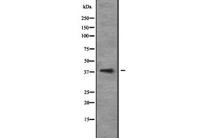 Western blot analysis of NEUROD6 expression in 293T whole cell lysate ,The lane on the left is treated with the antigen-specific peptide. (NEUROD6 antibody  (Internal Region))