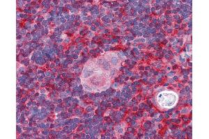 Anti-ARPC1B / p41-ARC antibody IHC of human thymus. (ARPC1B antibody  (AA 2-14))