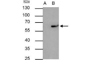 IP Image RAP1 antibody immunoprecipitates RAP1 protein in IP experiments. (RAP1 antibody  (Center))