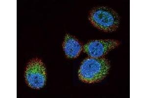 Confocal immunofluorescent analysis of HRAS antibody with MCF-7 cells followed by Alexa Fluor 488-conjugated goat anti-rabbit lgG (green). (HRAS antibody  (AA 104-128))