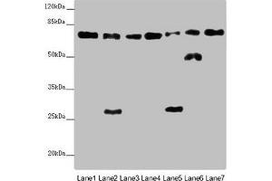 Western blot All lanes: ALB antibody at 2 μg/mL Lane 1: Mouse heart tissue Lane 2: Mouse liver tissue Lane 3: Mouse spleen tissue Lane 4: Mouse lung tissue Lane 5: Mouse kidney tissue Lane 6: Mouse brain tissue Lane 7: Mouse skeletal muscle tissue Secondary Goat polyclonal to rabbit IgG at 1/10000 dilution Predicted band size: 70, 48, 46 kDa Observed band size: 70, 50, 27 kDa (Albumin antibody  (AA 76-389))