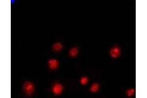Immunofluorescent analysis of PCGF6 staining in Hela cells. (PCGF6 antibody)
