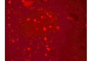 Immunofluorescence of ZGPAT in human brain cells with ZGPAT antibody at 20 ug/mL. (ZGPAT antibody  (C-Term))