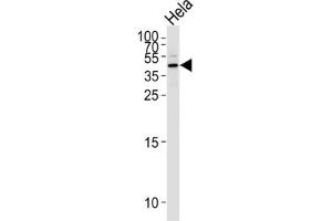 Western Blotting (WB) image for anti-serpin Peptidase Inhibitor, Clade B (Ovalbumin), Member 5 (SERPINB5) antibody (ABIN2996527)