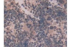 Immunohistochemistry (IHC) image for anti-Glutamate Dehydrogenase 1 (GLUD1) (AA 65-273) antibody (ABIN7431527)