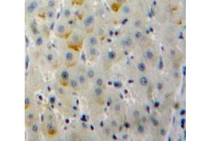 IHC-P analysis of Liver tissue, with DAB staining. (CD79b antibody  (AA 37-226))