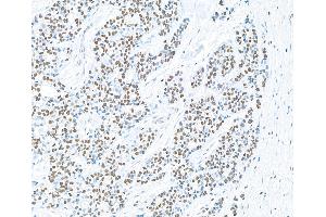 Immunohistochemistry (IHC) image for anti-Poly (ADP-Ribose) Polymerase 1 (PARP1) (AA 750-800) antibody (ABIN7449531) (Recombinant PARP1 antibody  (AA 750-800))