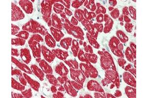Human Heart: Formalin-Fixed, Paraffin-Embedded (FFPE) (MYL4 antibody  (AA 2-197))