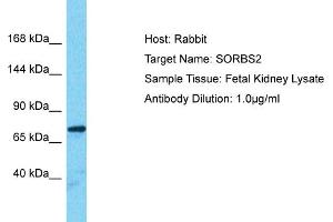 Host: Rabbit Target Name: SORBS2 Sample Type: Fetal Kidney lysates Antibody Dilution: 1. (Sorbs2 antibody  (Middle Region))