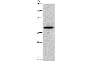 Western blot analysis of Human fetal liver tissue, using SERPINB3 Polyclonal Antibody at dilution of 1:200