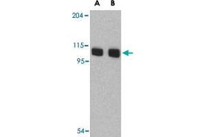 Western blot analysis of AOF2 in P815 cell lysate with AOF2 polyclonal antibody  at (A) 1 and (B) 2 ug/mL . (LSD1 antibody  (N-Term))