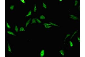 Immunofluorescent analysis of Hela cells using ABIN7170500 at dilution of 1:100 and Alexa Fluor 488-congugated AffiniPure Goat Anti-Rabbit IgG(H+L) (STRBP antibody  (AA 201-500))