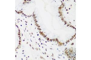 Immunohistochemistry of paraffin-embedded human gastric using PCNA antibody (ABIN1874056) at dilution of 1:200 (40x lens). (PCNA antibody)