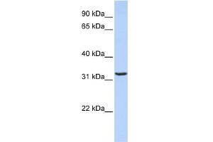 WB Suggested Anti-JMJD8 Antibody Titration: 0. (JMJD8 antibody  (Middle Region))
