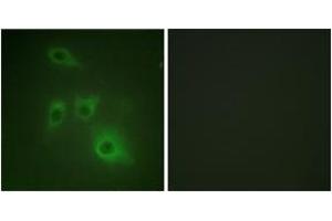Immunofluorescence analysis of HuvEc cells, using HSP90B (Ab-226) Antibody.