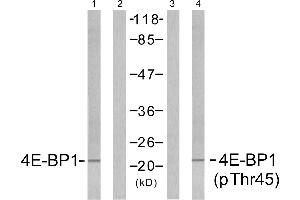 Western blot analysis of extracts from MDA435 cells untreated or treated with EGF (200nm, 5mins), using 4E-BP1 (Ab-45) antibody (Linand 2) and 4E-BP1 (phospho-Thr45) antibody (Line 3 and 4). (eIF4EBP1 antibody  (pThr45))
