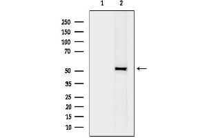 anti-Radical S-Adenosyl Methionine Domain Containing 1 (RSAD1) (Internal Region) antibody