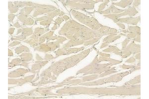 ABIN6258204 and ABIN6273883 at 1/100 staining human tongue carcinoma by IHC-P. (GPR56 antibody  (C-Term))