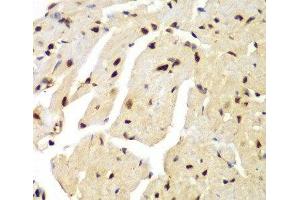 Immunohistochemistry of paraffin-embedded Mouse heart using LIG3 Polyclonal Antibody at dilution of 1:100 (40x lens). (LIG3 antibody)