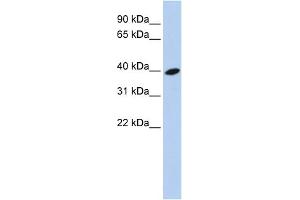 WB Suggested Anti-ARL13B Antibody Titration: 0. (ARL13B antibody  (Middle Region))