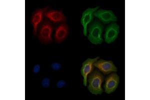 ABIN6256612 and ABIN6267176 staining heat-shock treated Hela cells by IF/ICC. (INPP5D antibody  (pTyr1020, pTyr1022))