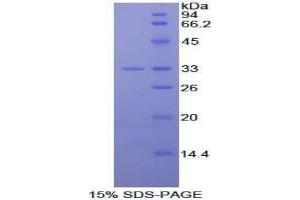 SDS-PAGE analysis of Mouse IL20Ra Protein.