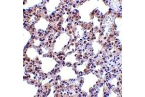 Immunohistochemistry (IHC) image for anti-Eukaryotic Translation Initiation Factor 2-alpha Kinase 2 (EIF2AK2) (N-Term) antibody (ABIN1031517)