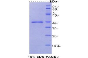 SDS-PAGE (SDS) image for Coagulation Factor III (thromboplastin, Tissue Factor) (F3) (AA 34-251) protein (His tag) (ABIN1080937) (Tissue factor Protein (AA 34-251) (His tag))