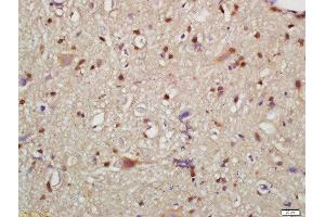 Formalin-fixed and paraffin embedded mouse brain labeled with Rabbit Anti-HMGCR(Ser872) Polyclonal Antibody, Unconjugated  at 1:200 followed by conjugation to the secondary antibody and DAB staining (HMGCR antibody  (pSer872))