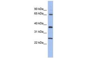 Image no. 1 for anti-HORMA Domain Containing 2 (HORMAD2) (AA 107-156) antibody (ABIN6743696) (HORMAD2 antibody  (AA 107-156))