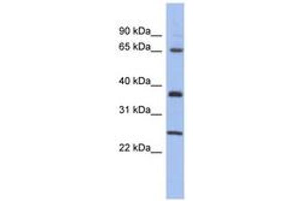 HORMAD2 anticorps  (AA 107-156)