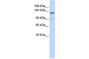 WB Suggested Anti-EIF4G2 Antibody Titration:  0. (EIF4G2 antibody  (N-Term))