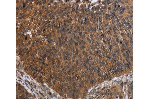 Immunohistochemistry of Human brain  using FCGR3A Polyclonal Antibody at dilution of 1:60 (FCGR3A antibody)