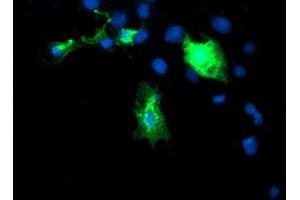 Image no. 3 for anti-DIX Domain Containing 1 (DIXDC1) antibody (ABIN1497840) (DIXDC1 antibody)