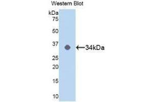 Detection of Recombinant MAPK14, Human using Polyclonal Antibody to Mitogen Activated Protein Kinase 14 (MAPK14) (MAPK14 antibody  (AA 19-279))