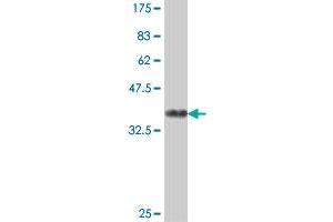 Western Blot detection against Immunogen (37. (AP1G2 antibody  (AA 686-785))